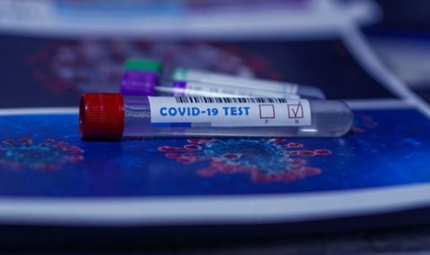 Berikut Harga Terbaru Tes PCR COVID-19