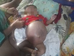 Bayi 6 Bulan Asal Batealit Menderita Kanker, Pemkab Jepara Kurang Optimal Tangani Warga Pengidap Kanker