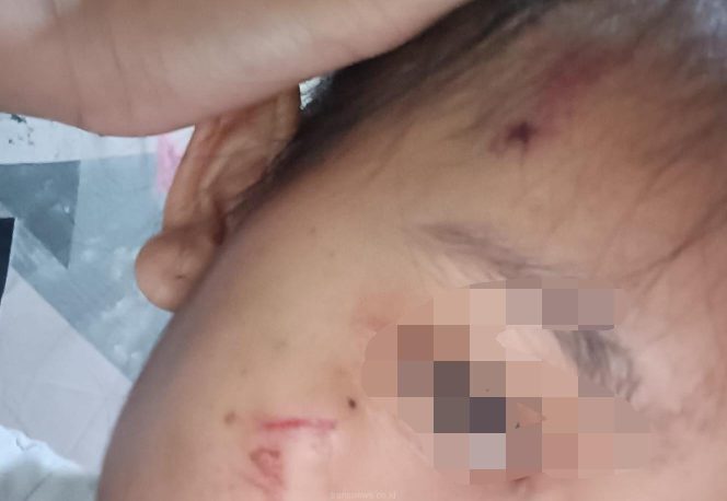 
					ART Diduga Dianiaya Istri TNI di Depok