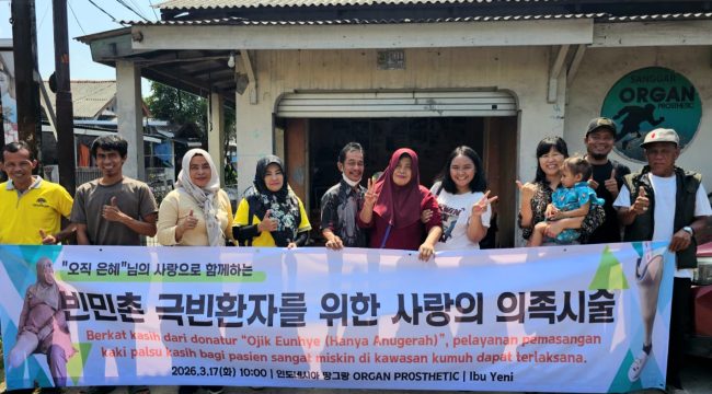 Konsisten Menebar Kebaikan, YGP Salurkan Kaki Palsu Untuk Warga Depok